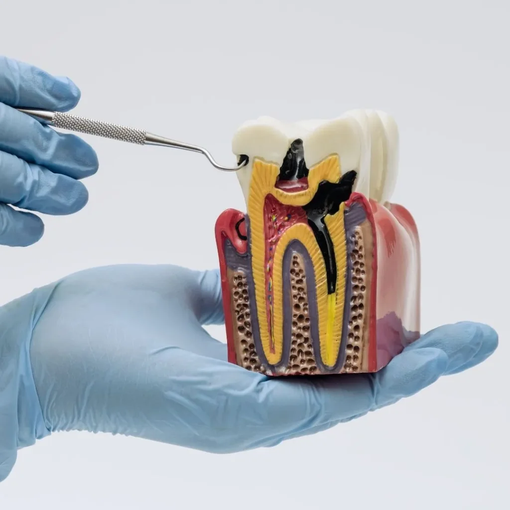 endodontist in Dubai